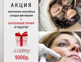 Заполнение носогубной складки филлерами за 9000 рублей